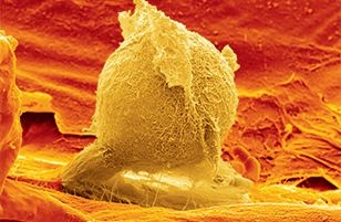 Electron microscopy