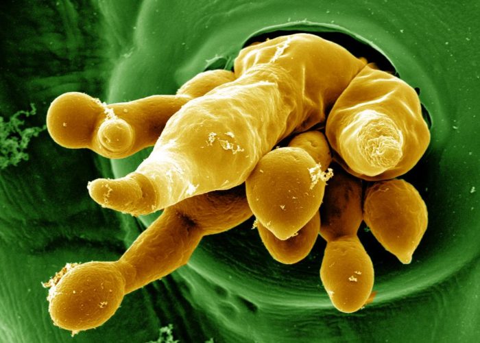 Feuille de tournesol infecté par l'oomycète plasmopara Hasteldii
