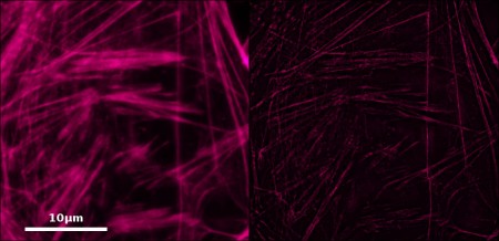 Filaments of actin with and without the super-resolution module. © CBI – T. Mangeat & A. Negash