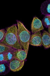 HeLa cells stained for DNA (blue, Hoechst 44432), microtubules (yellow, anti-tubulin Alexa 488) and F-actin (magenta, phalloidin Abberior STAR Red). Courtesy of A. Politi, J. Jakobi and P. Lenart, MPI for Biophysical Chemistry, Göttingen, Germany.